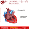 میوکاردیت یا التهاب عضله قلب چیست؟