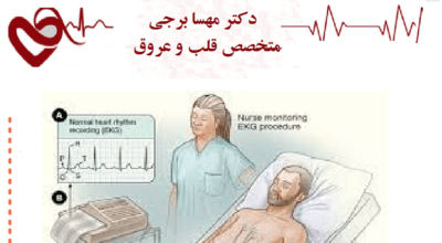 کاربرد نوار قلب (ECG) چیست؟