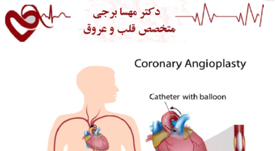 بعد از آنژیوپلاستی چه اتفاقی برای قلب می افتد؟