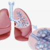 درباره ریه و مجاری تنفسی بیشتر بدانید